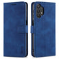 AZNS Skin Feel Calf Texture Horizontal Flip Leather Case with Card Slots & Holder & Wallet, For Honor Play 5T Youth, For Samsung Galaxy A22 4G, For Samsung Galaxy A32 5G, For Samsung Galaxy A42 5G, For Samsung Galaxy A82 5G